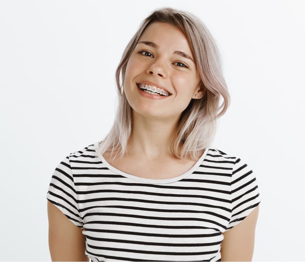 invisalign aligners on model